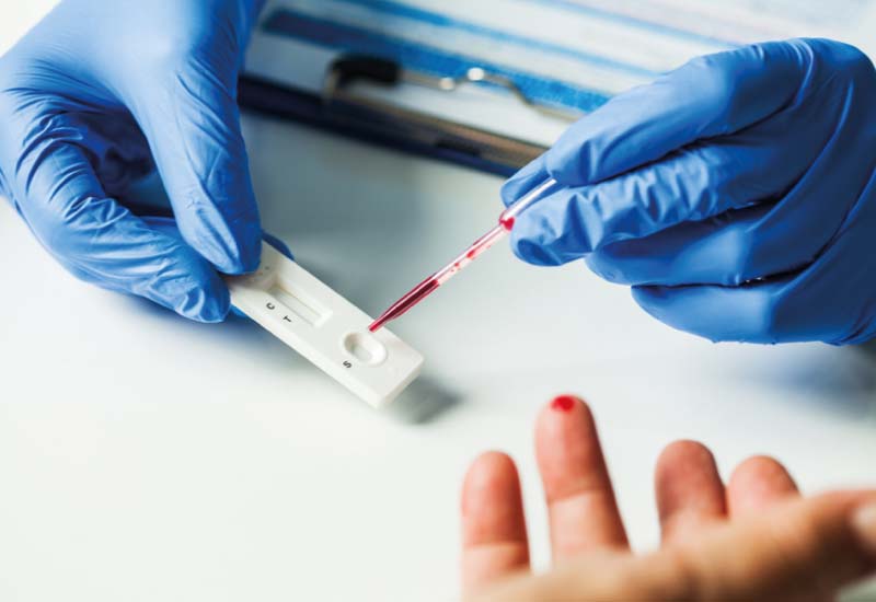 Test rápido serológico | Pruebas COVID-19 | Laboratorio Ganivet | Laboratorio de análisis clínicos en Granada